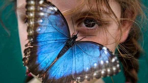 Буллезный эпидермолиз. Формы буллезного эпидермолиза