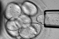 Ученые впервые создали печень из стволовых клеток
