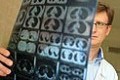 В Могилеве пройдет акция "Победим рак вместе"